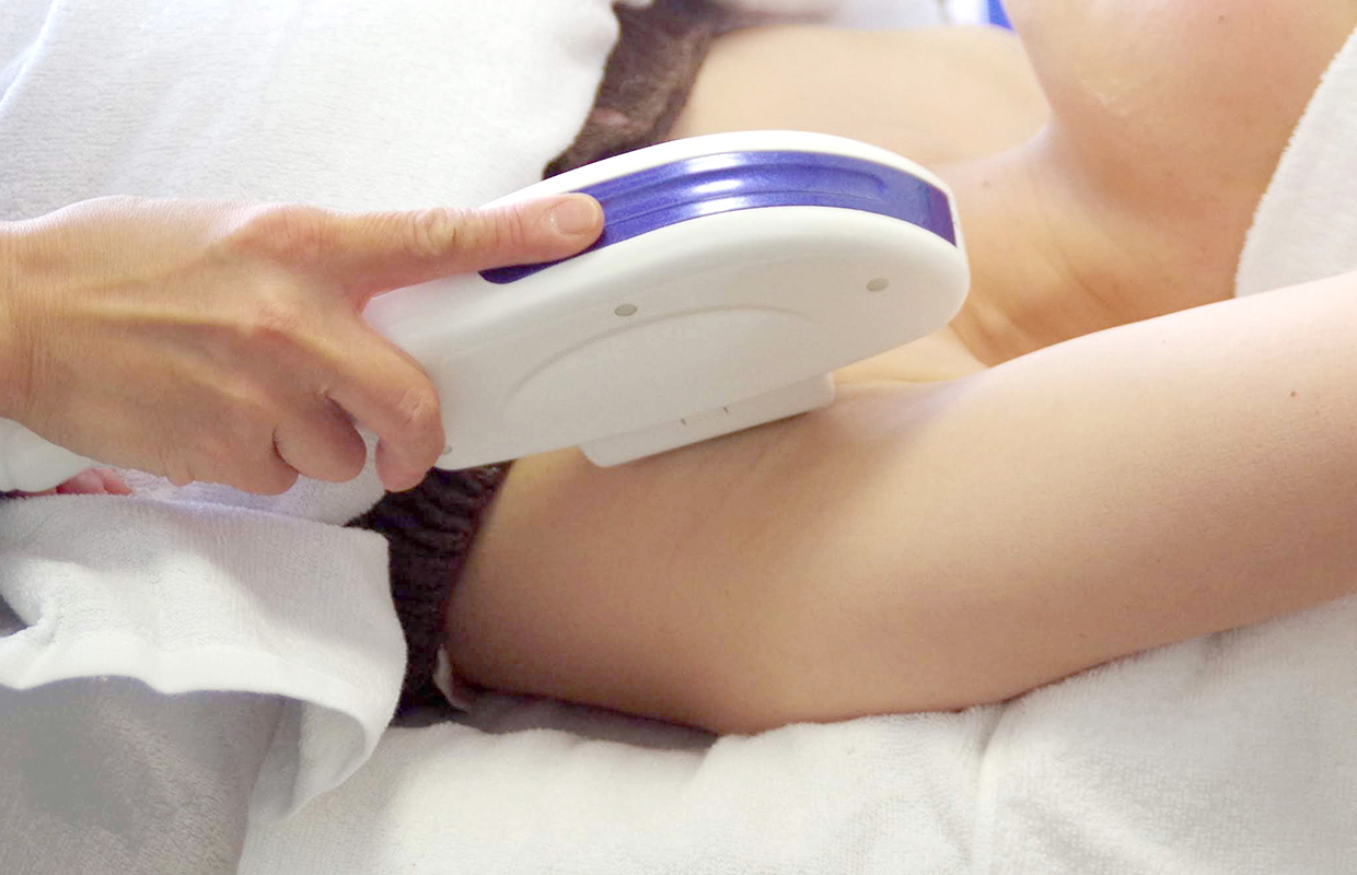 美肌脱毛