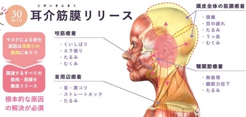 耳介筋膜リリース
