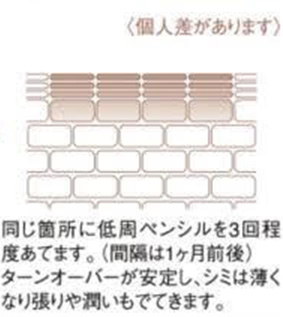 シミデトックスの施術説明3