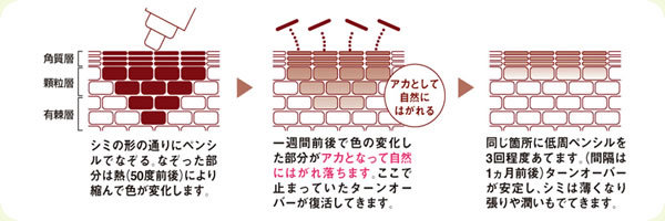 ALICIA シミデトックス ALICIA シミデトックス