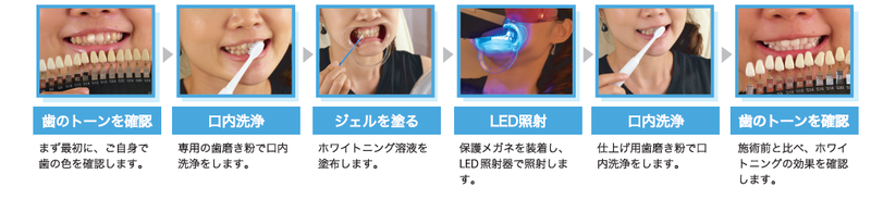 ALICIA セルフホワイトニング