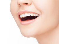 歯のセルフホワイトニングはじめました♪